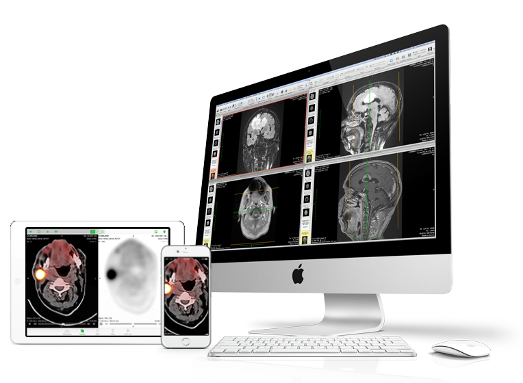 OsiriX Lite (macOS), how to handle backups OsiriX Lite (macOS), DICOM import and export tutorial with recovery tips