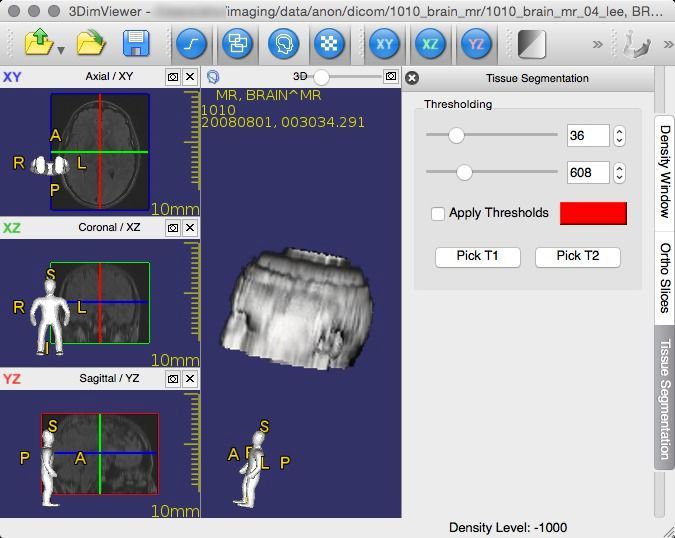 3DimViewer, how to set up 3DimViewer, clinical workflow with snapshots and restore points