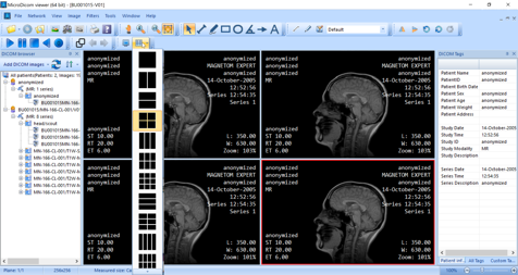 MicroDicom, how to troubleshoot MicroDicom, secure repositories with encryption for dental data