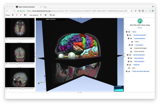 OpenAnatomy Dental Atlas, how to handle backups OpenAnatomy Dental Atlas, DICOM import and export tutorial with recovery tips